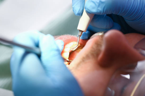 Best Emergency Dental Surgery in Travis Ranch, TX