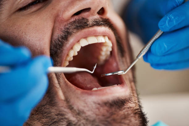 Best Pediatric Emergency Dentist in Travis Ranch, TX