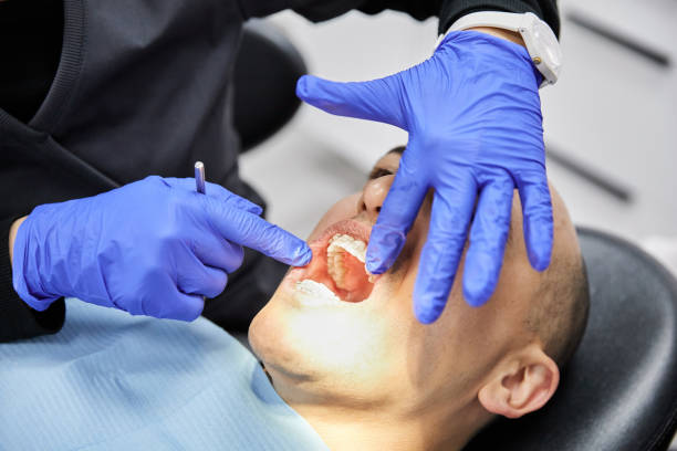 Best Emergency Tooth Extraction in Travis Ranch, TX